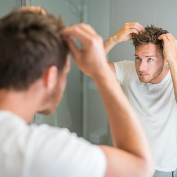 hair loss in man