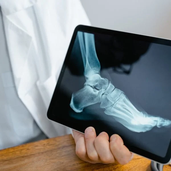 person holding an x ray result of a foot